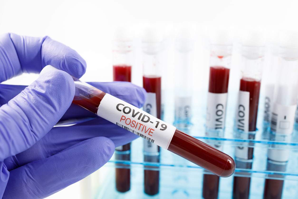 Alerta: variante “Frankenstein” del COVID detectada en Brasil