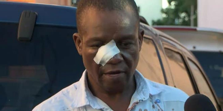 Profesor Naony Anderson acude a Fiscalía tras agresión en liceo Juan Pablo Duarte