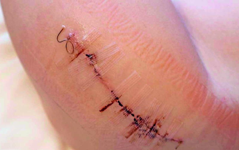 Joven es herida con arma blanca en Santiago tras discusión por una “mala palabra”